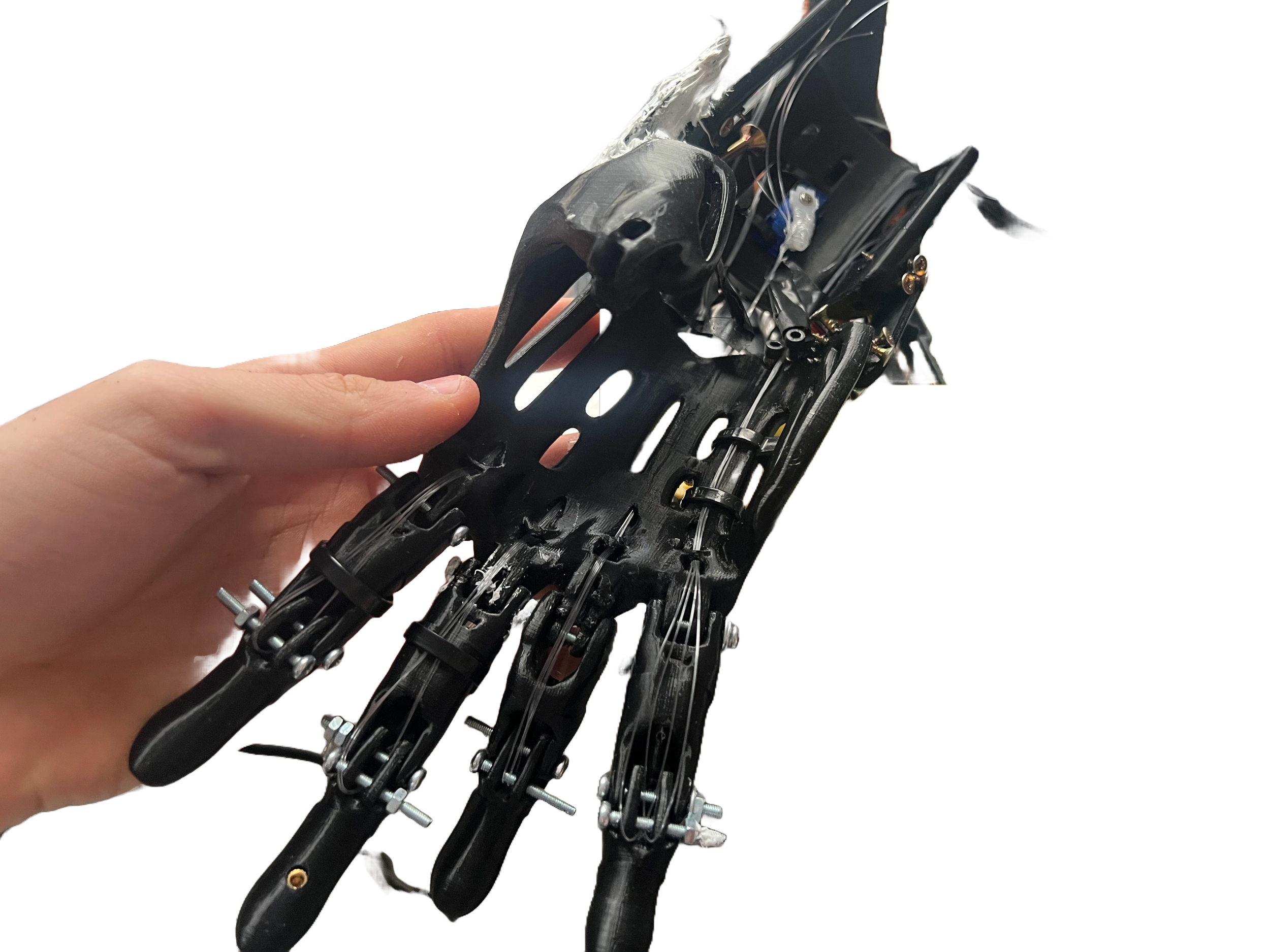 EMG-Controlled 3D Printed Prosthetic Hand